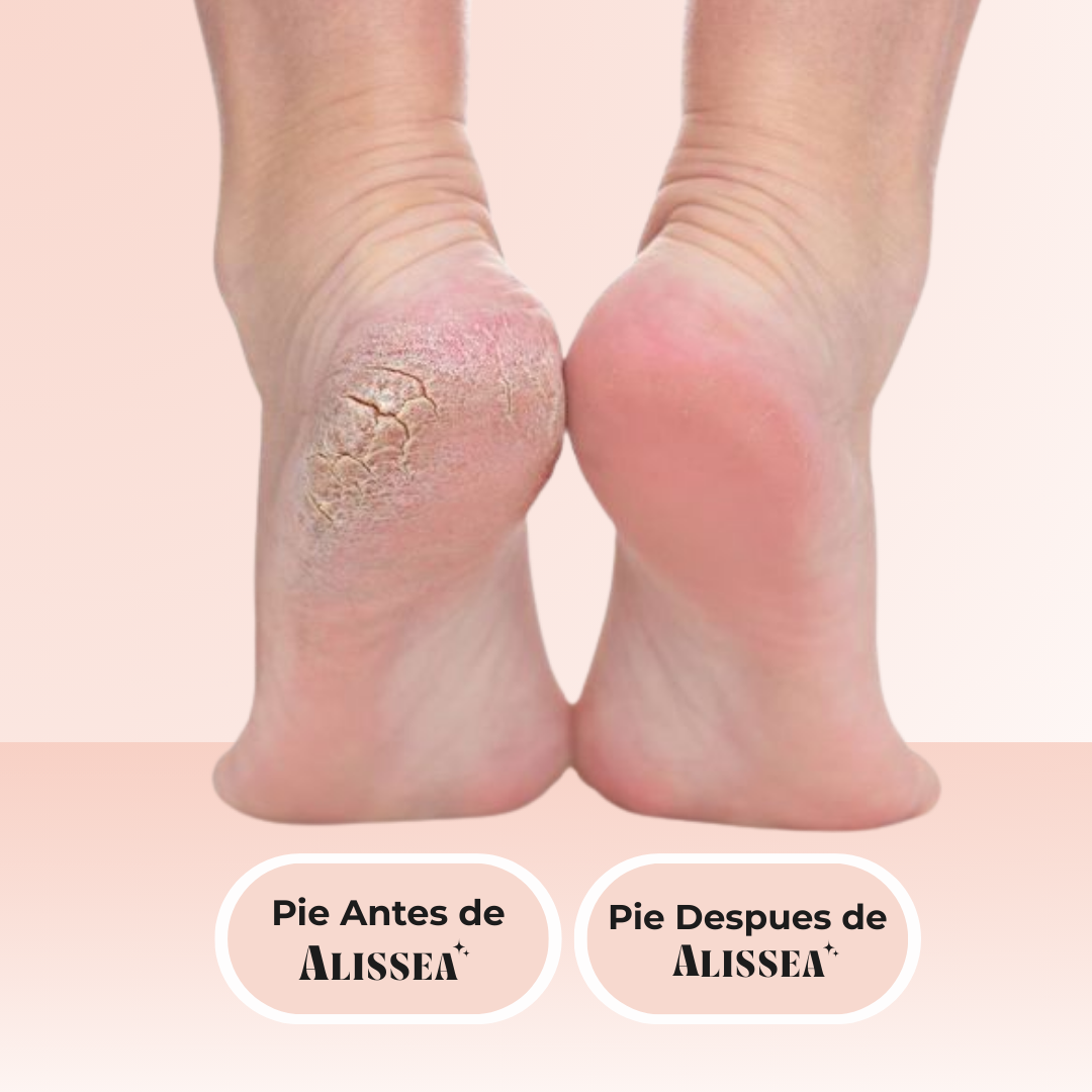 Alissea™ Renovación de Piel en Casa